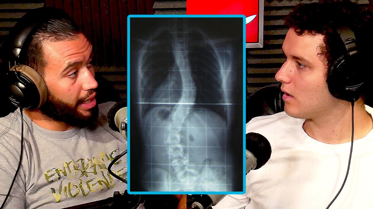 UFC Star Shane Burgos Almost Had to Give Up Fighting Due to Scoliosis