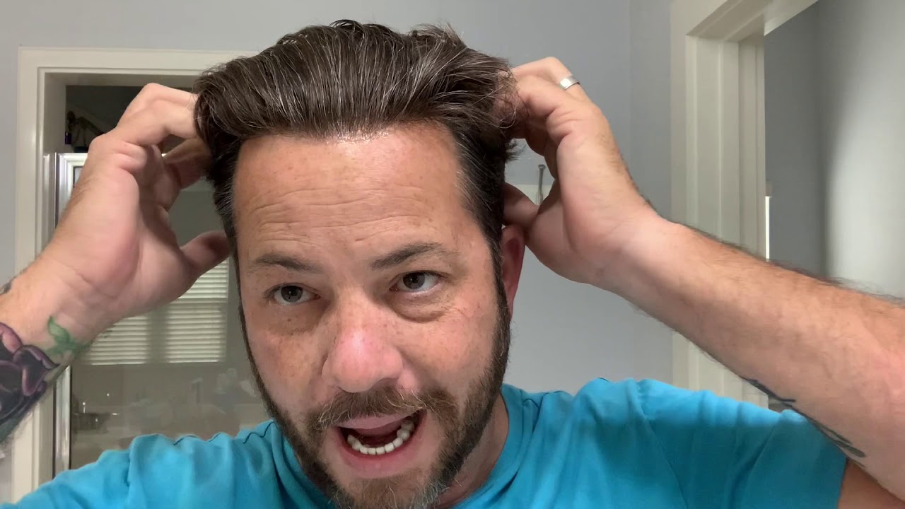 How to Fix Common Issues With A Hair Replacement Or Hair System