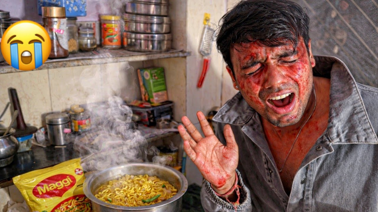 Maggi se pura face jal gya 😭 omg 