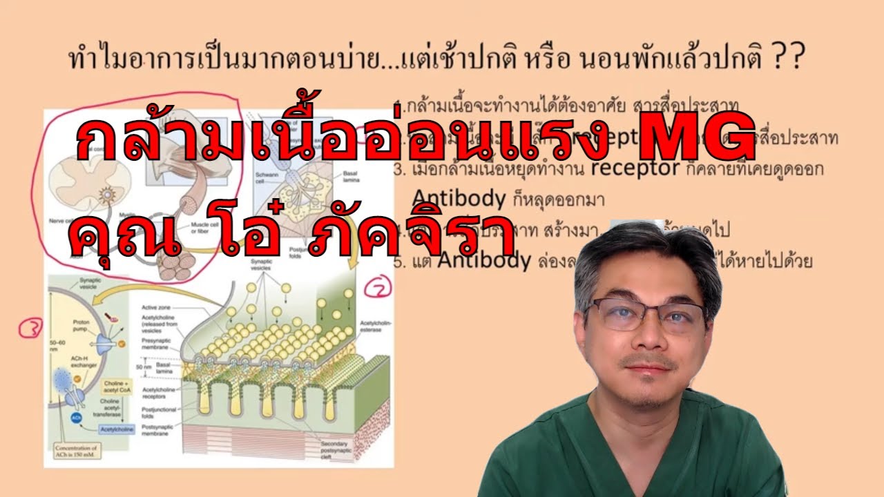 คนดังกับโรค : คุณโอ๋ ภัคจีรา กับโรคประหลาด กล้ามเนื้ออ่อนแรงจากภูมิคุ้มกัน