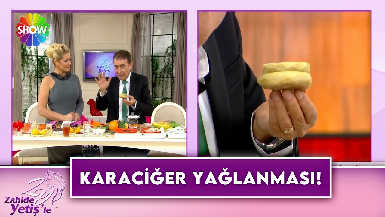 Dr. Murat Topoğlu önerileri ile karaciğer yağlanmasına son!