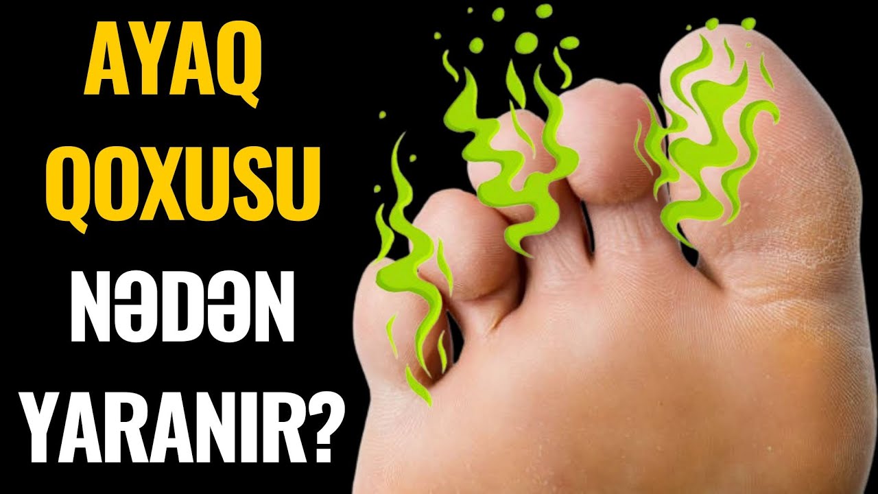 PİS AYAQ QOXUSUNUN Səbəbi | Dermatoloq Şövqü Salahov