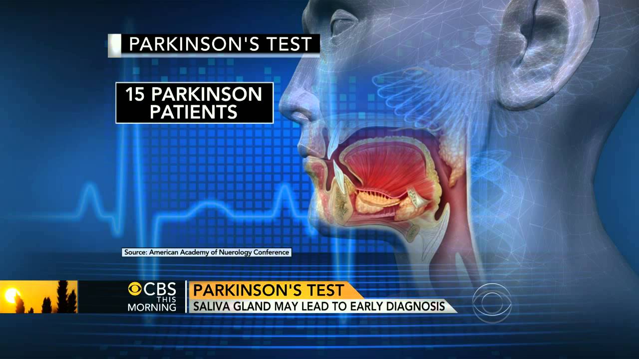 Saliva could be used to diagnose Parkinson's: Study