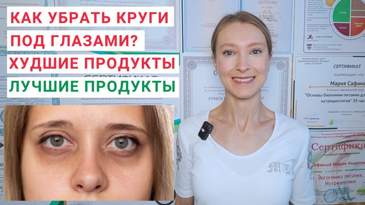 КАК УБРАТЬ ТЕМНЫЕ КРУГИ ПОД ГЛАЗАМИ? Почему у женщин появляются круги под глазами? Здоровое питание.