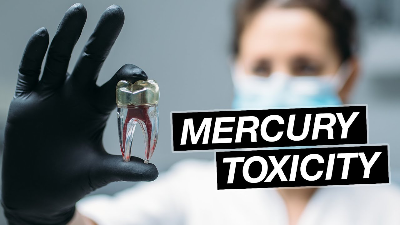 Are Amalgam Fillings Safe?  New FDA Recommendations for Mercury Amalgam Restorations