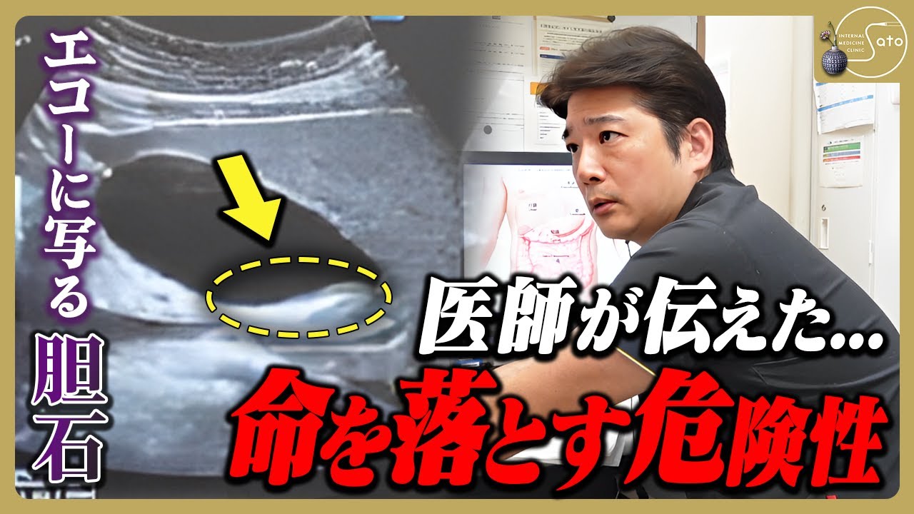 『激痛！摘出？緊急手術！？』医師が患者に力説！胆管炎の痛みで命を落とす危険性！？