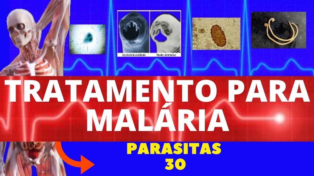 TRATAMENTO PARA MALÁRIA - PARASITOLOGIA | INFECTOLOGIA