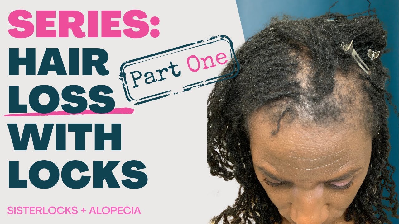 Locks + Hair Loss Series | Part 1 | Did you know I had HAIR LOSS with my SISTERLOCKS on thin hair?