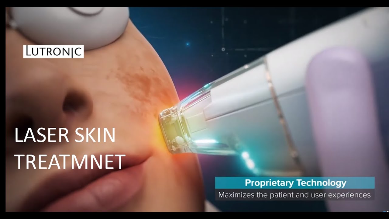 Laser Skin Treatment - LaseMD by Lutronic 2020 (Medical Device 3D Animation)