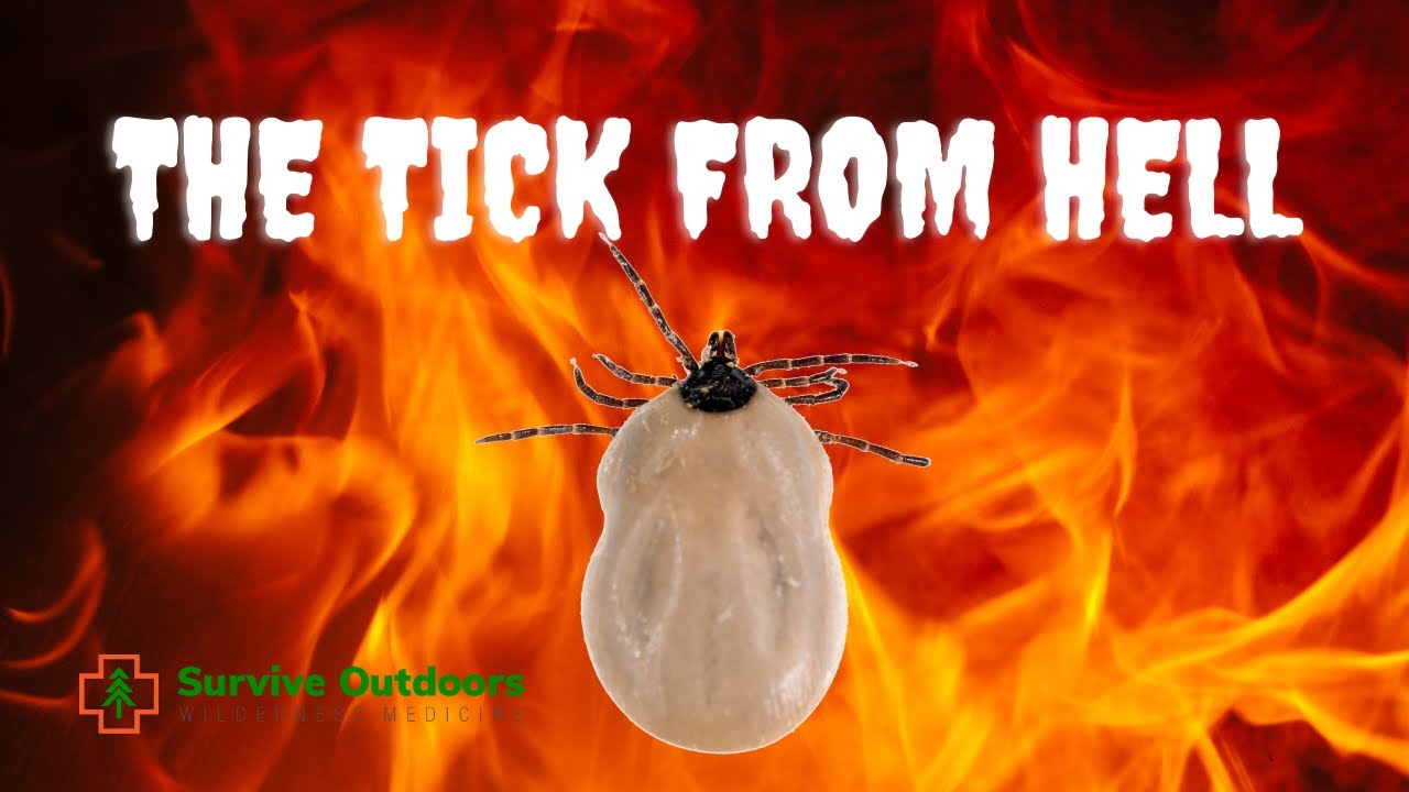 TICK BITE Case Study  Ehrlichia Chaffeensis