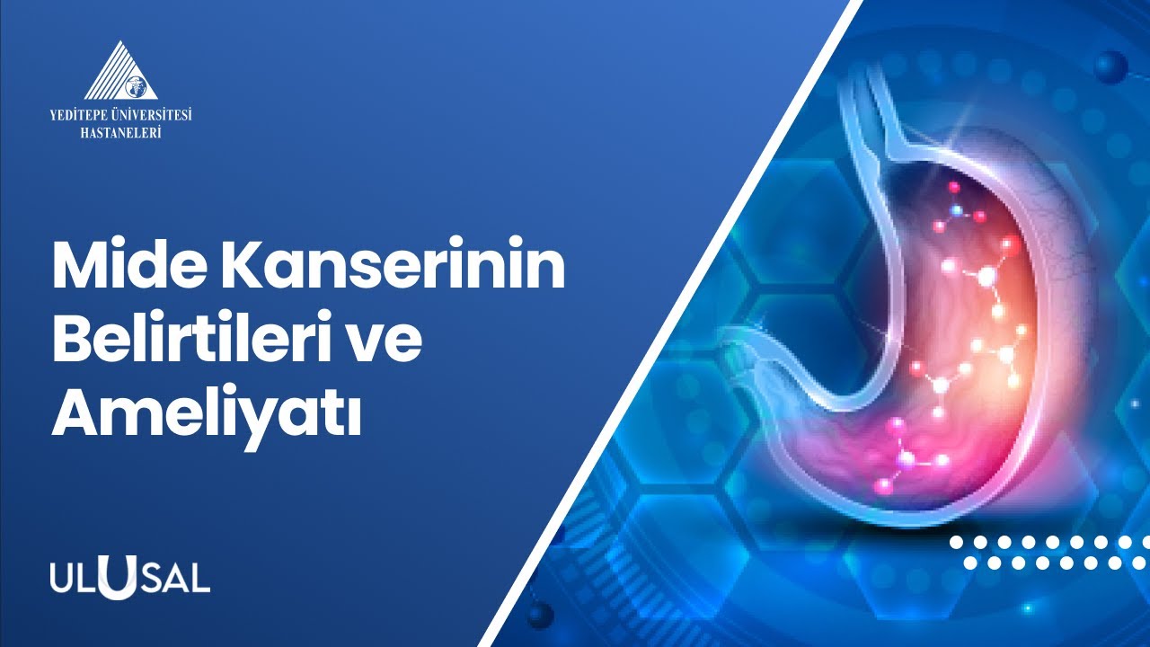 Mide Kanserinin Belirtileri ve Ameliyatı