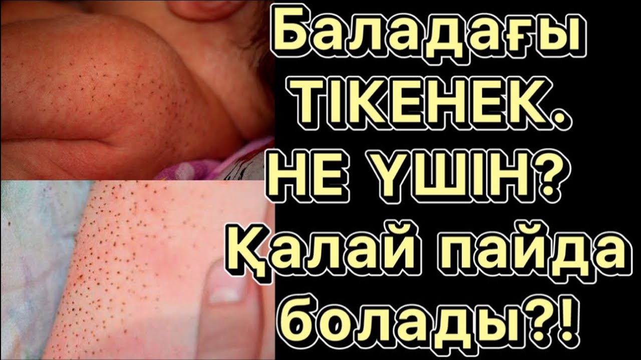 ЗАНОЗА на спине у ребёнка. ПОЧЕМУ ОНА ВЫХОДИТ?! Как от неё избавиться?!