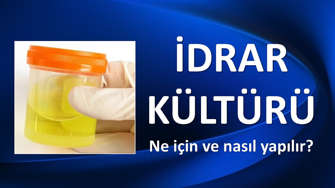 İDRAR KÜLTÜRÜ NEDİR, NE İÇİN VE NASIL YAPILIR?