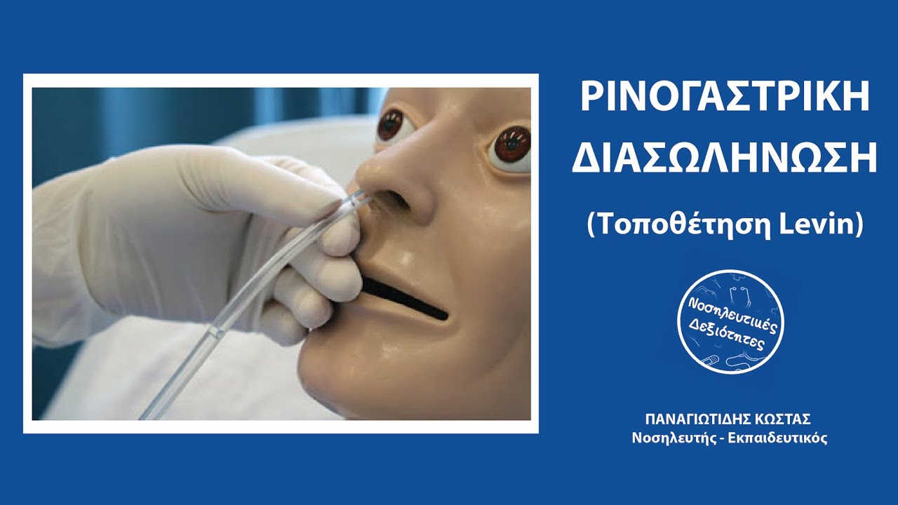 Τοποθέτηση ρινογαστρικού σωλήνα (Levin).