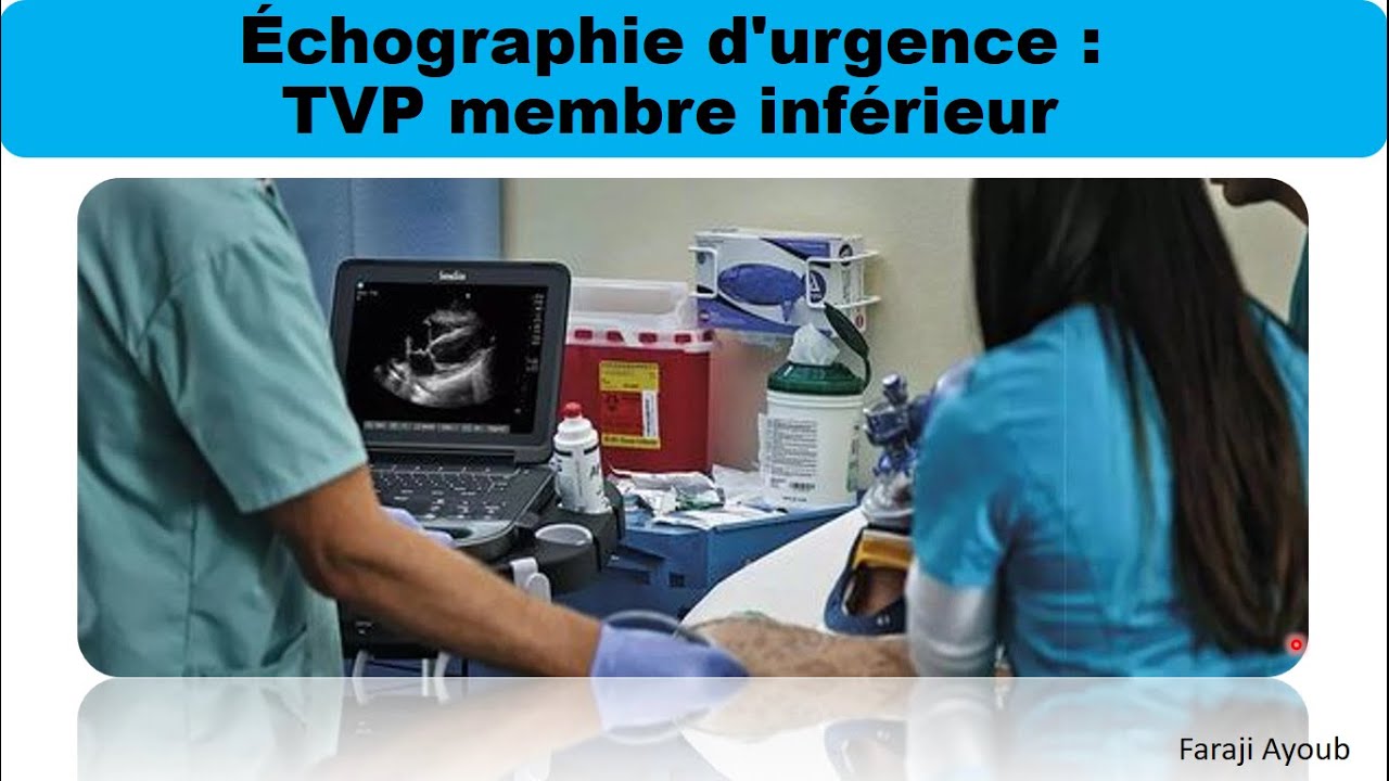 échographie d'urgence 2 : La thrombose veineuse profonde (TVP) des membres inférieurs