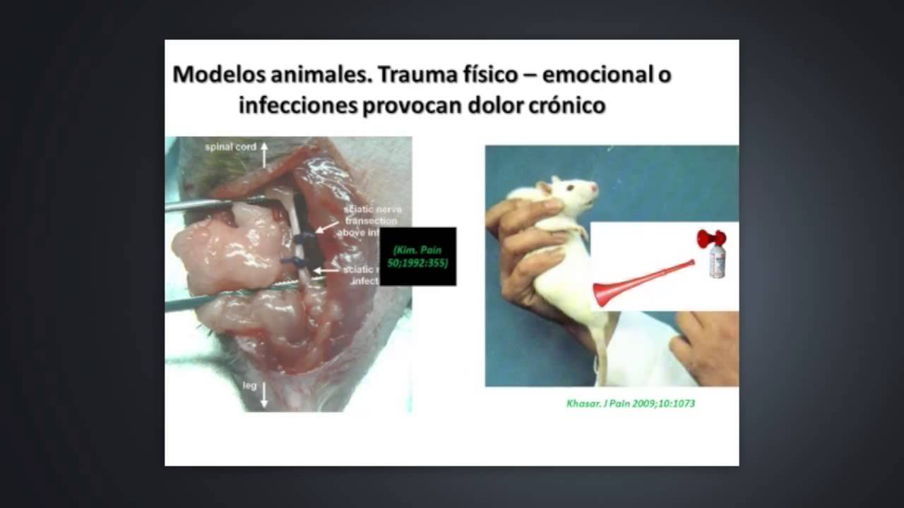 Actualización en fibromialgia
