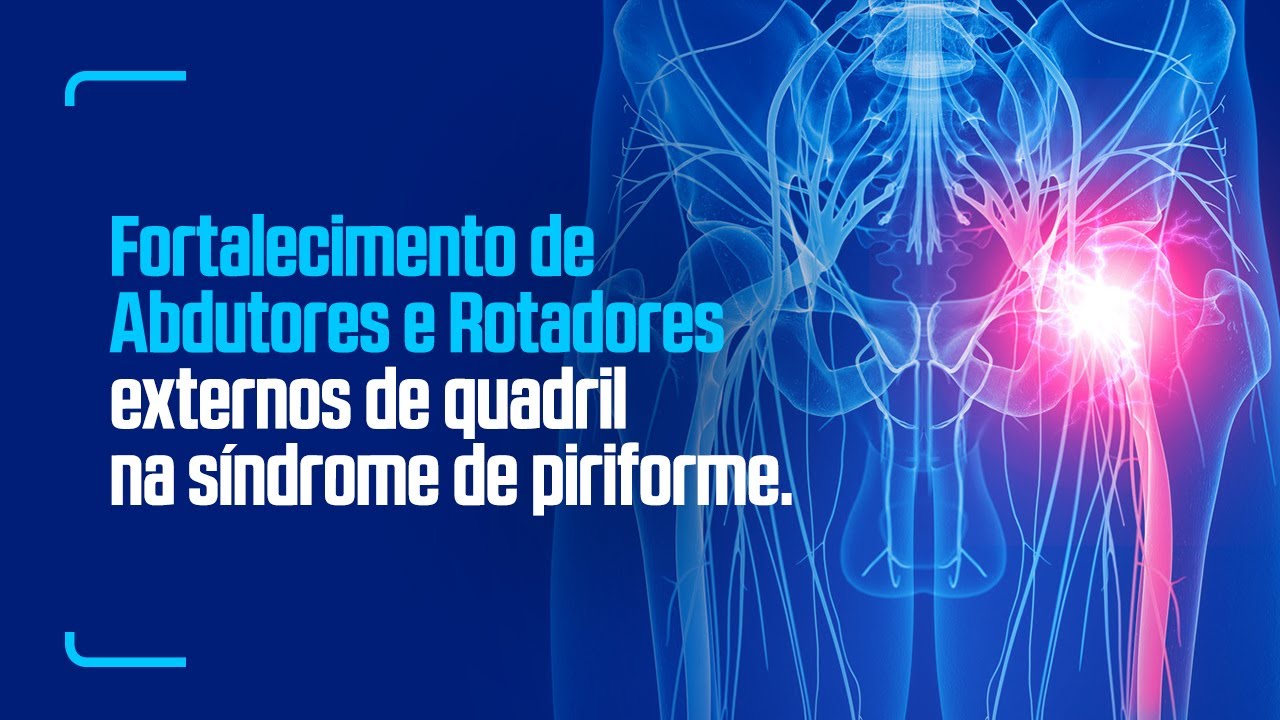 Fortalecimento de abdutores e rotadores externos de quadril na síndrome de piriforme