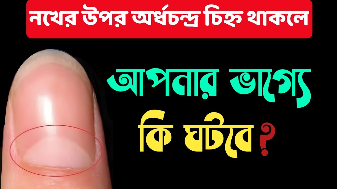 নখের উপর অর্ধচন্দ্র সাদা দাগ থাকলে ভাগ্যে যা ঘটে থাকে || Half moon mark on nails