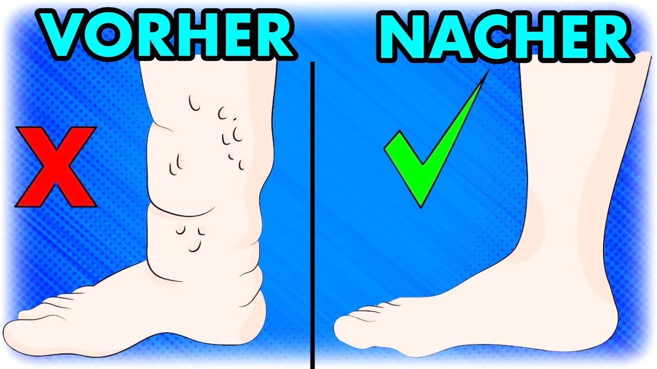 Abend-Routine gegen Lymph&ouml;dem: 3 &Uuml;bungen f&uuml;r &Uuml;50 zur schnellen Linderung!