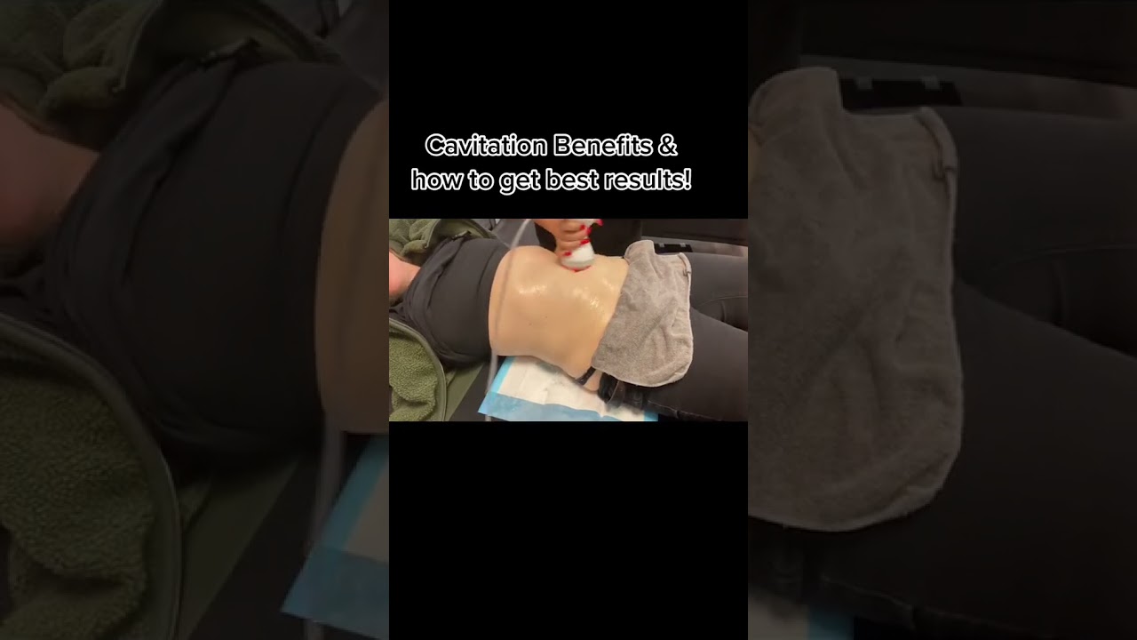 How to get the best results in body Sculpting? #bodysculpting #cavitation #bodycontouring #viral
