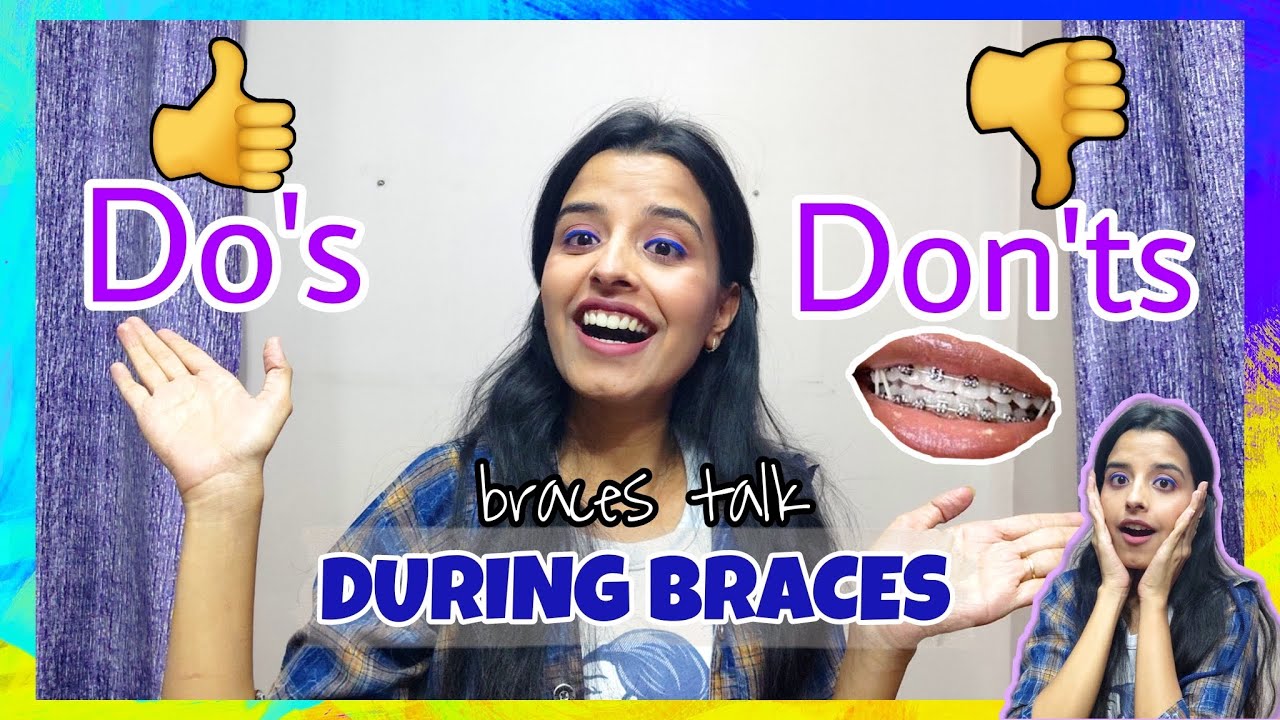Do's and Don'ts during Braces | Dental Hygiene,Food habits & much more| Everything you need to know