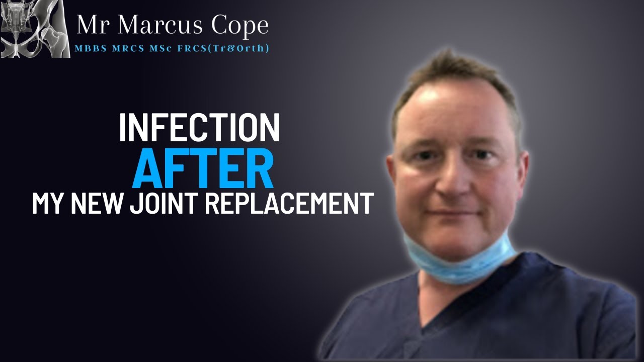 Infections in hip and knee replacements