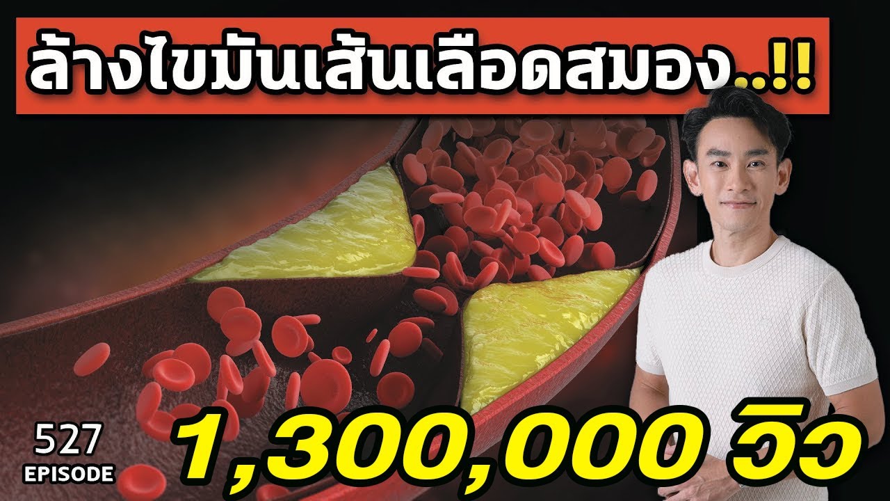 7 เทคนิคล้างไขมันจากหลอดเลือดสมอง ใน 3 เดือน | หมอท๊อป EP527
