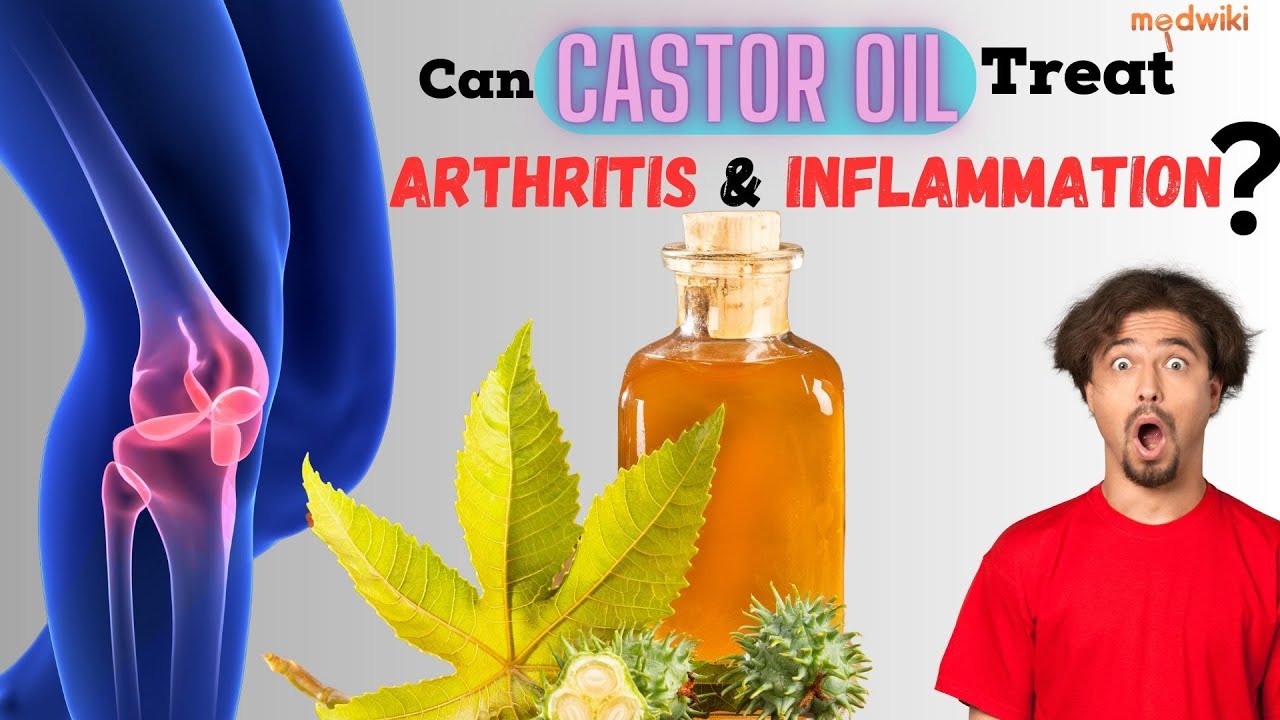 Discover the Power of Castor Oil for Treating Arthritis and Inflammation!