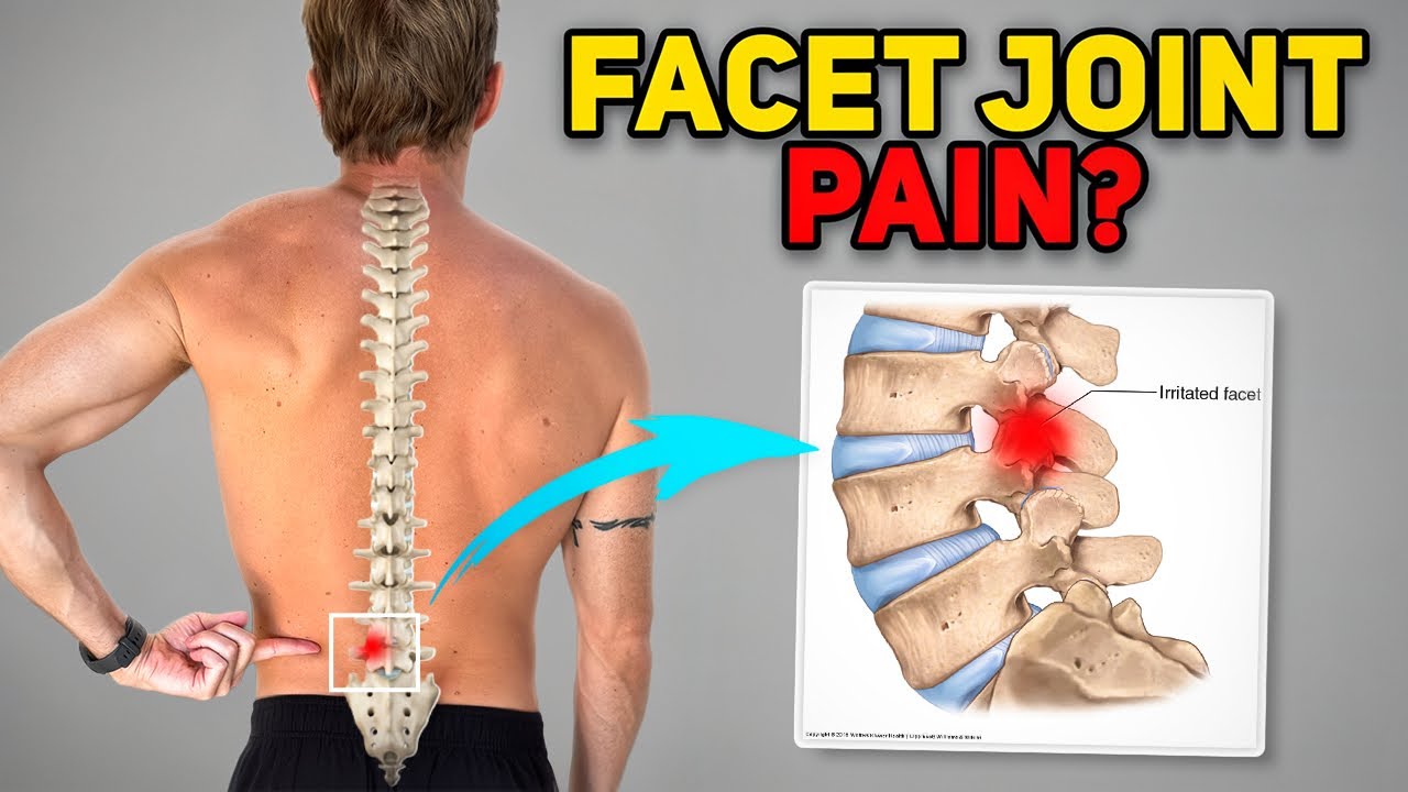 4 Exercises for Lumbar Facet Joint Pain (Low Back Joints)