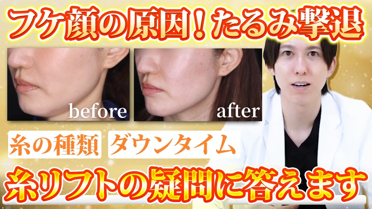 【たるみ撃退】糸リフトの疑問にアラン先生が答えます！