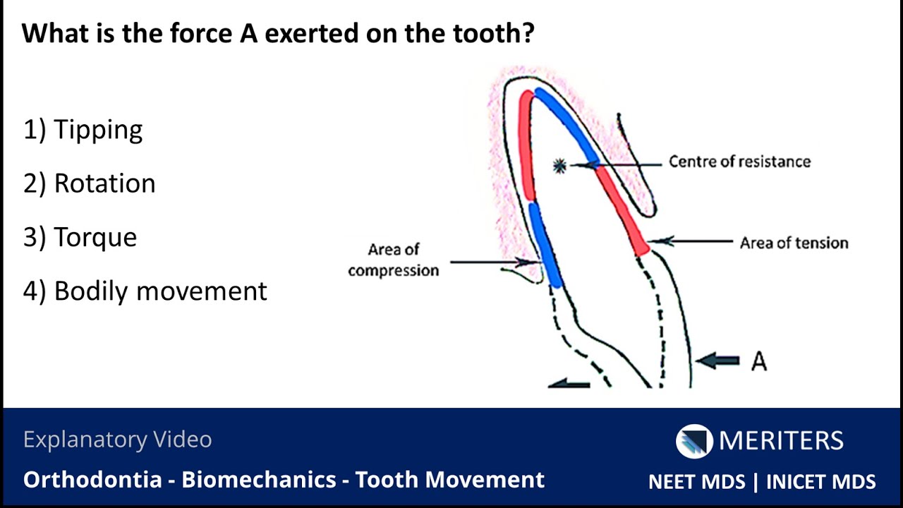 NEET MDS | INICET - Orthodontia - Biomechanics - Tooth Movement | Explanatory Video | MERITERS