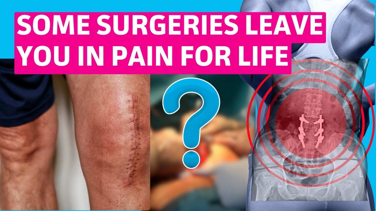 Surgery Gone Wrong: The 6 Procedures Causing Chronic Pain