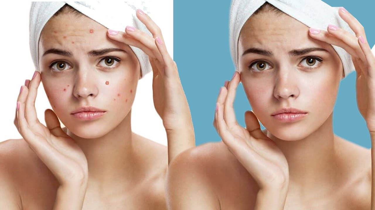 Heal Layers Tool Remove Unwanted Objects + Fix Skin - Capture One Pro tutorial