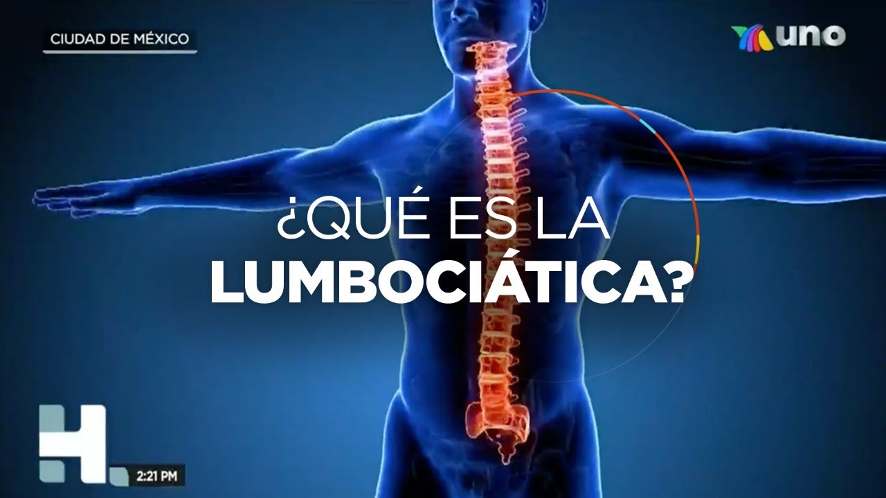 &iquest;Qu&eacute; es la lumboci&aacute;tica? Dolor de columna que comprime el nervio