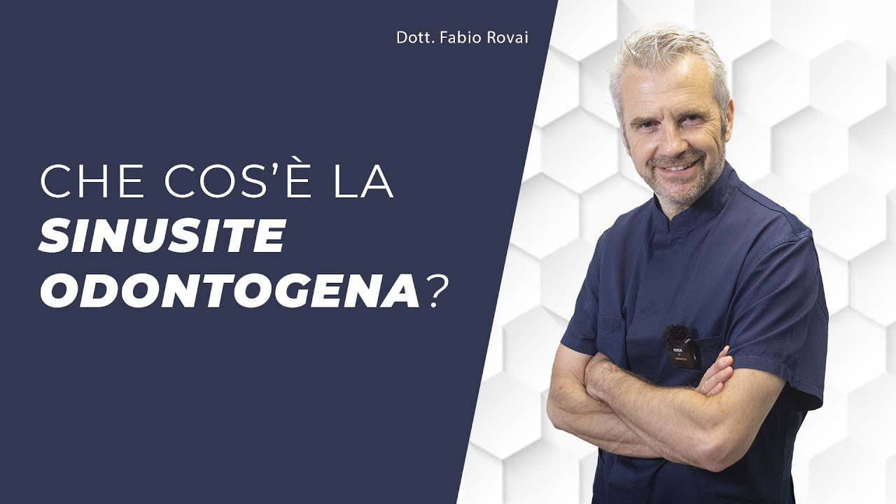 SINUSITE ODONTOGENA...CHE COS'È?