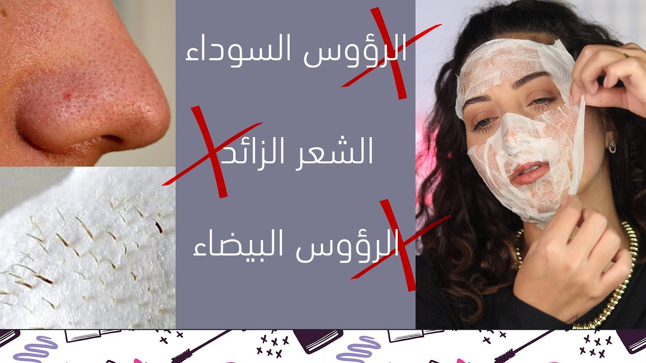 بمكونين فقط تخلّصتُ من الرؤوس السوداء + الرؤوس البيضاء + الشعر الزائد | ماسك للوجه