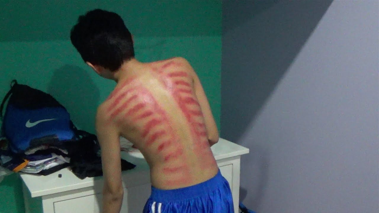KEROKAN / DIKEROKIN (INDONESIA TRADITIONAL HEALING MASSAGE)