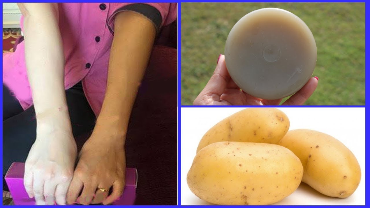 Homemade POTATO MILK SOAP For Milky Whiten Skin Permanently | Get Milky White Skin Instantly