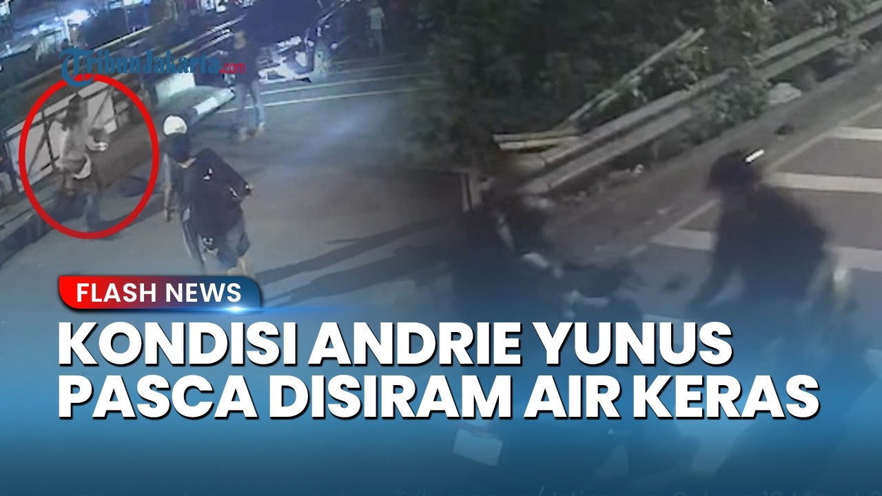 Aktivis KontraS Alami Luka Bakar 24%, Mata Andrie Yunus Harus Dioperasi Akibat Siraman Air Keras