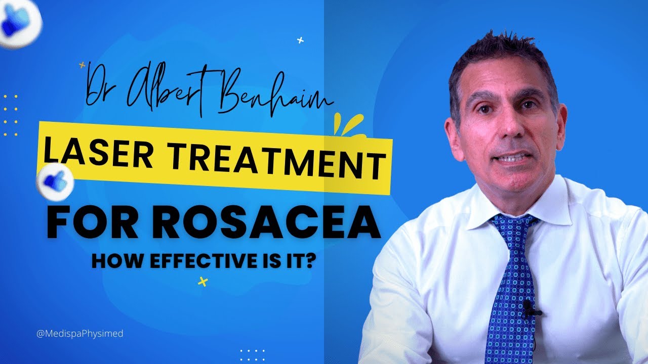 Laser Treatment For Rosacea: How Effective Is It?