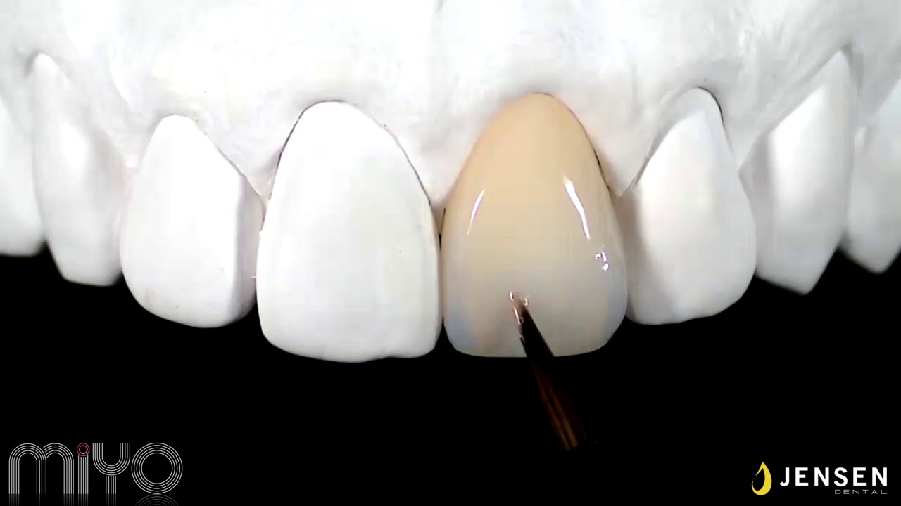 MiYO Esthetic Finishing System One Shot Technique