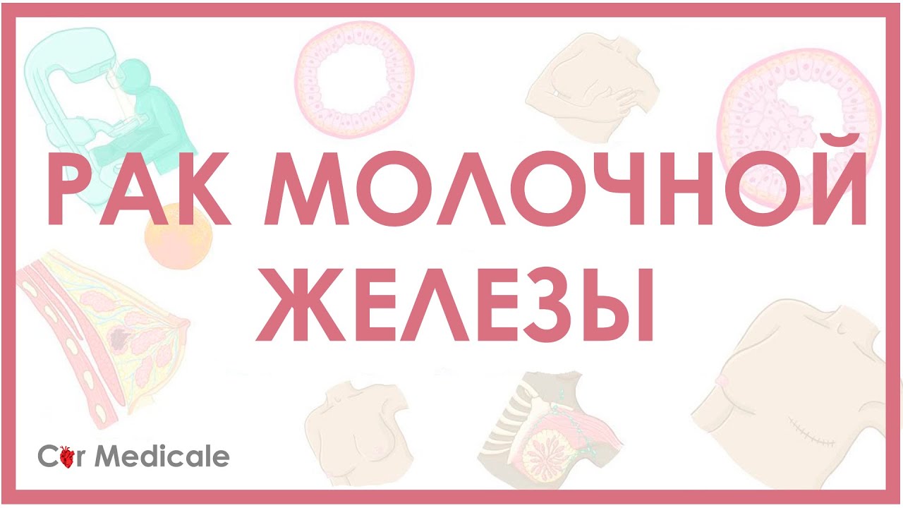 Рак молочной железы