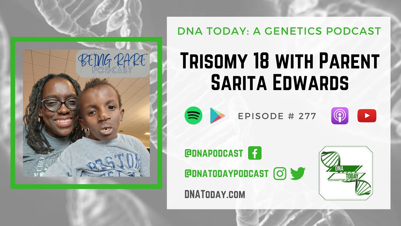 Trisomy 18 with Parent Sarita Edwards