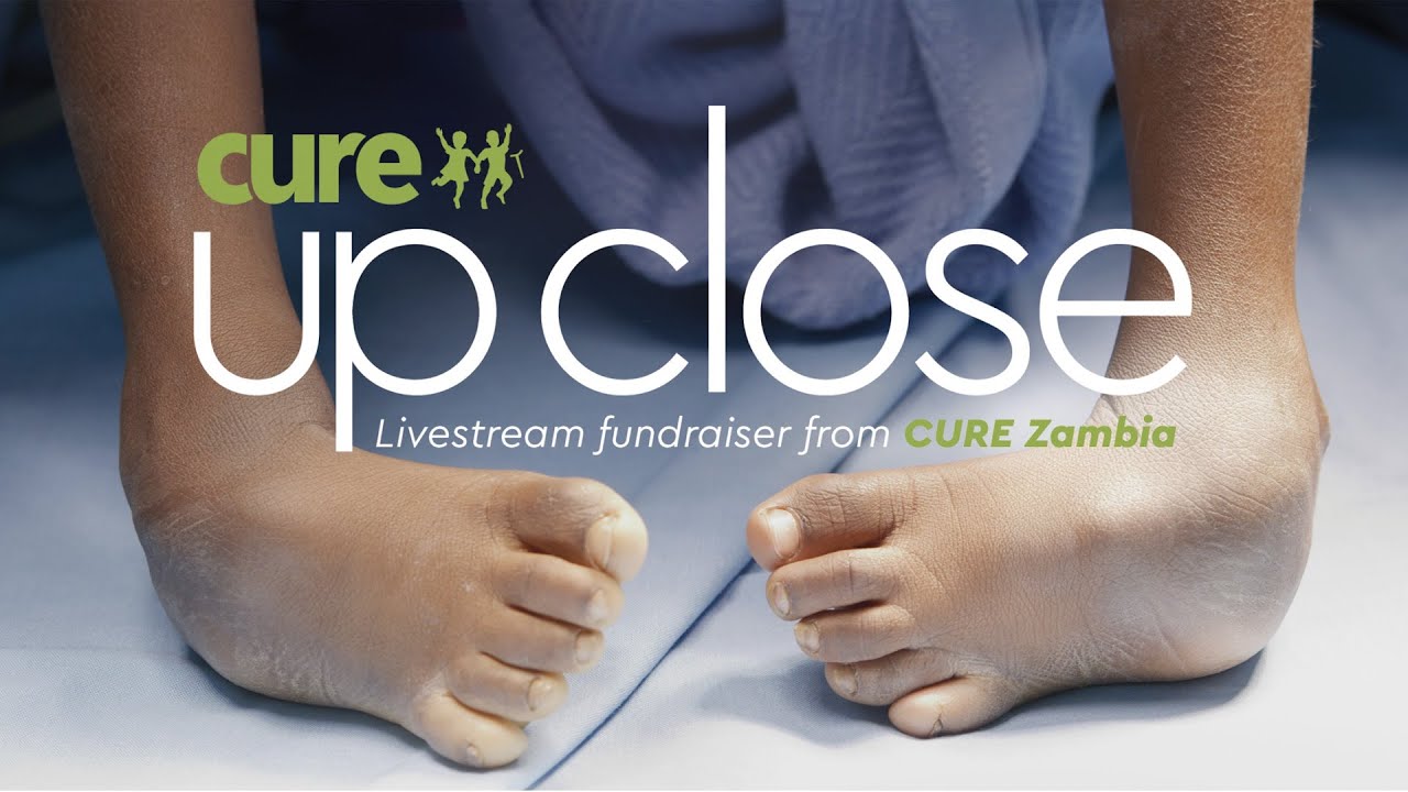 CURE Up Close