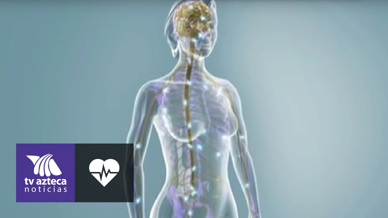 &iquest;C&oacute;mo afecta la esclerosis m&uacute;ltiple al cerebro?