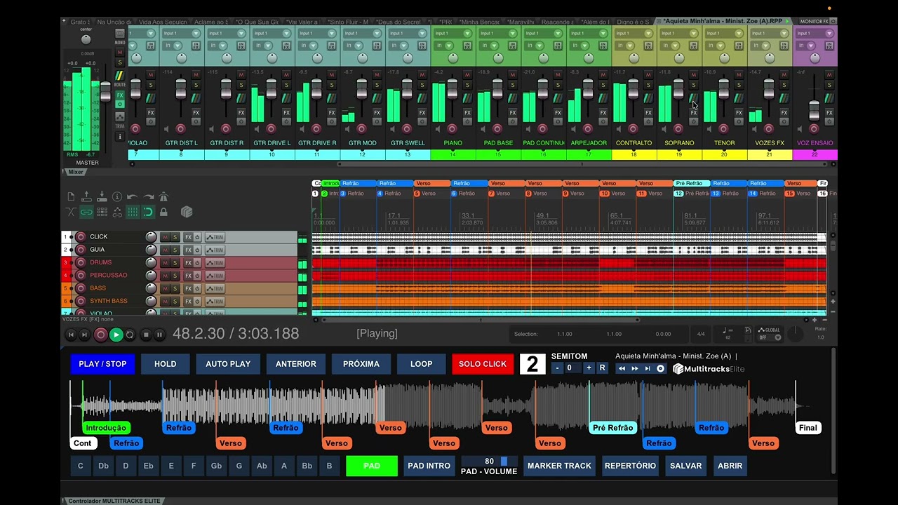Aquieta Minh'Alma - Ministério Zoe #multitracks #playbacks 