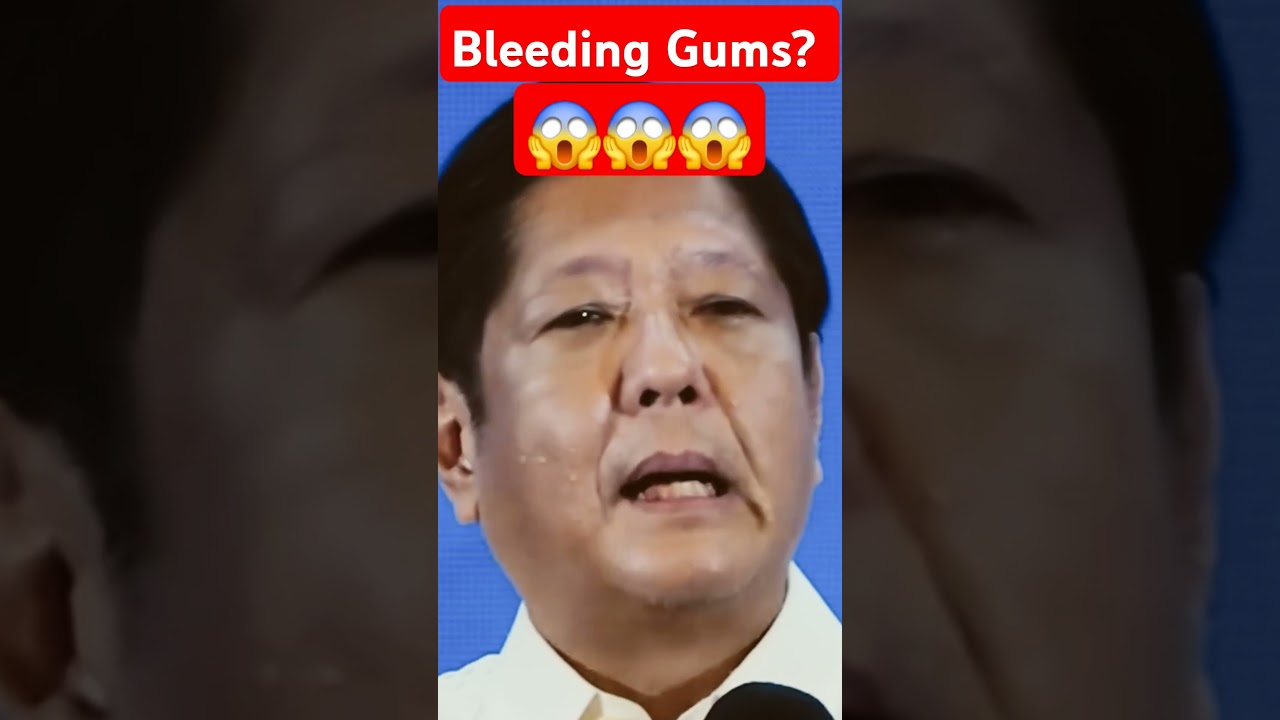 MAY SAKIT NGA BA SI PBBM?  BAKIT NAGDUDUGO ANG GILAGID?  #bbm #pbbm #bbc #bbcnews #bongbongmarcos