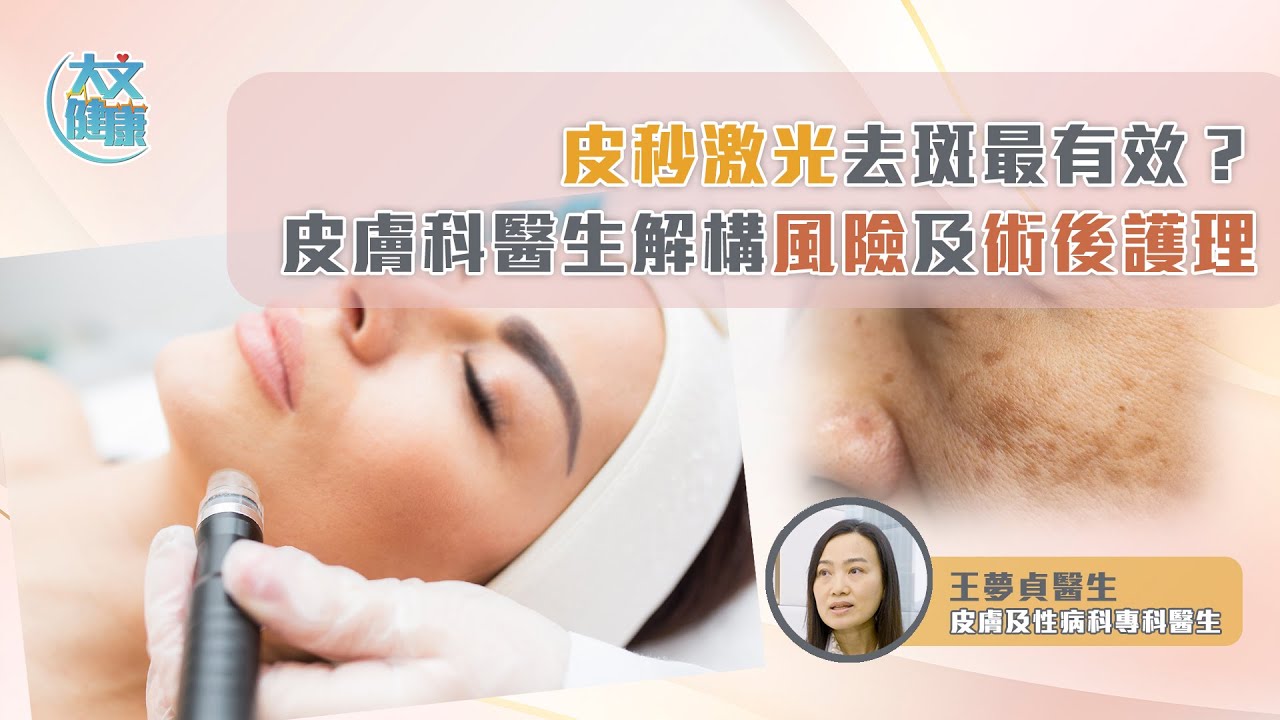 皮秒激光去斑最有效？ 皮膚科醫生解構風險及術後護理