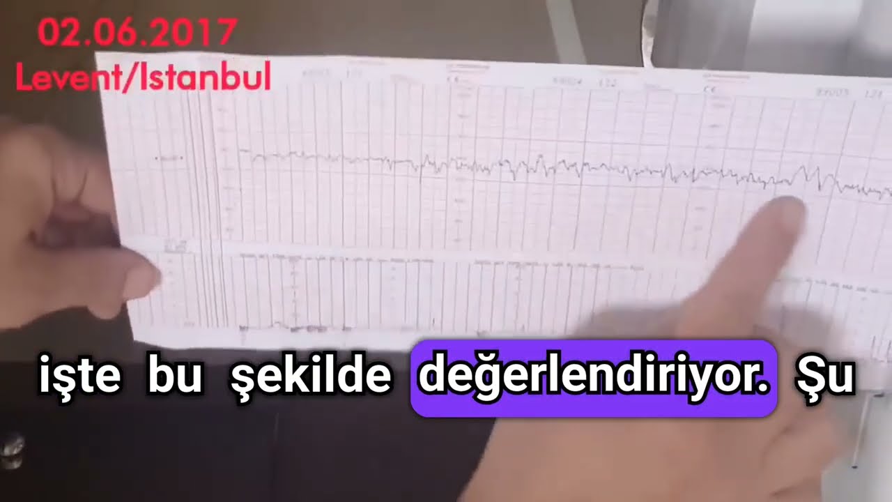 Gebelikte NST nasıl ve neden yapılır, neler gösterir? Kasılma ve bebeğe giden kan akımını gösterir.