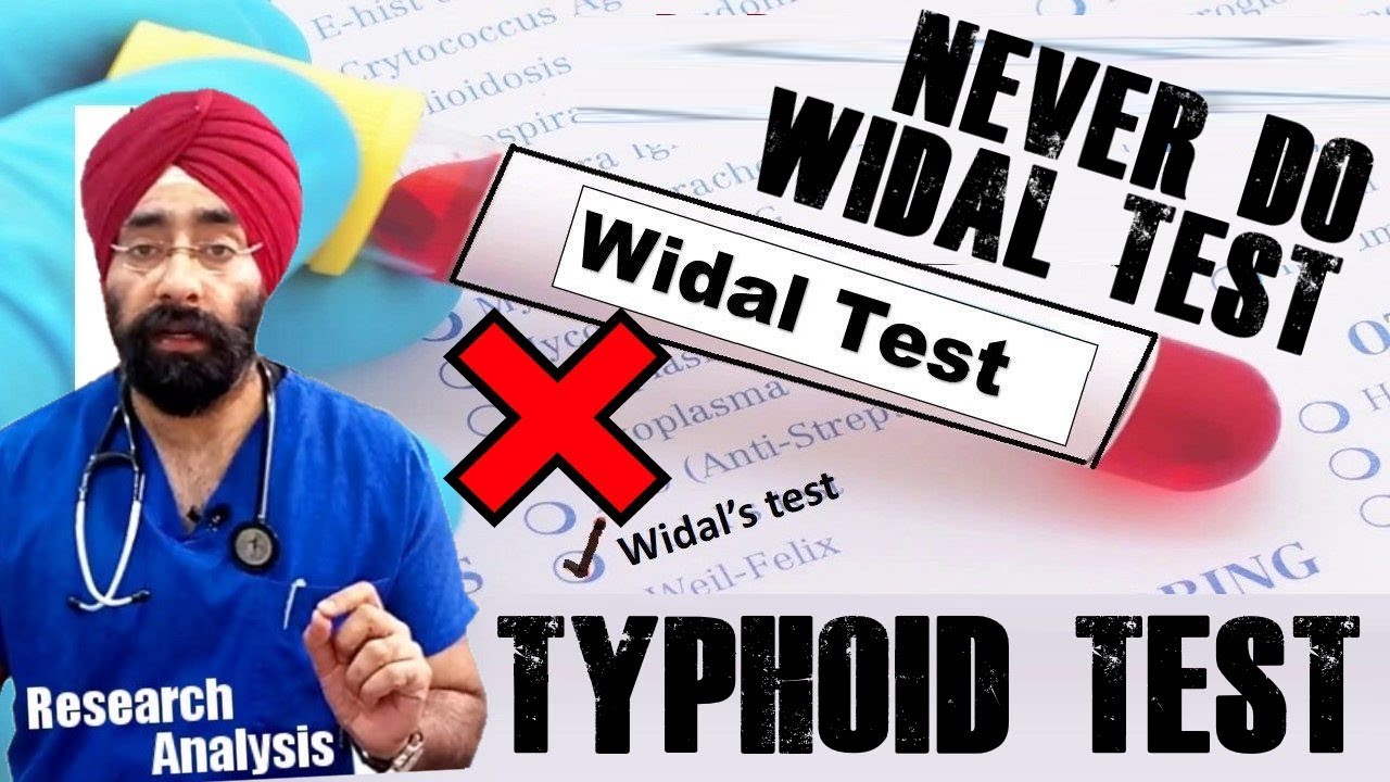 How  to Diagnose Typhoid Fever | Never do Widal test | Dr.Education (Eng)